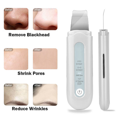 Ultrasonic Skin Scrubber